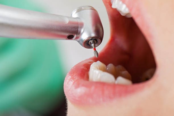 Best Weekend Emergency Dental Services in Branford Center, CT